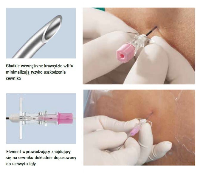 PERICAN 1.3 x 120MM G18 IGŁA DO ZNIECZULEŃ ZEWNĄTRZOPONOWYCH 4512453 BBRAUN